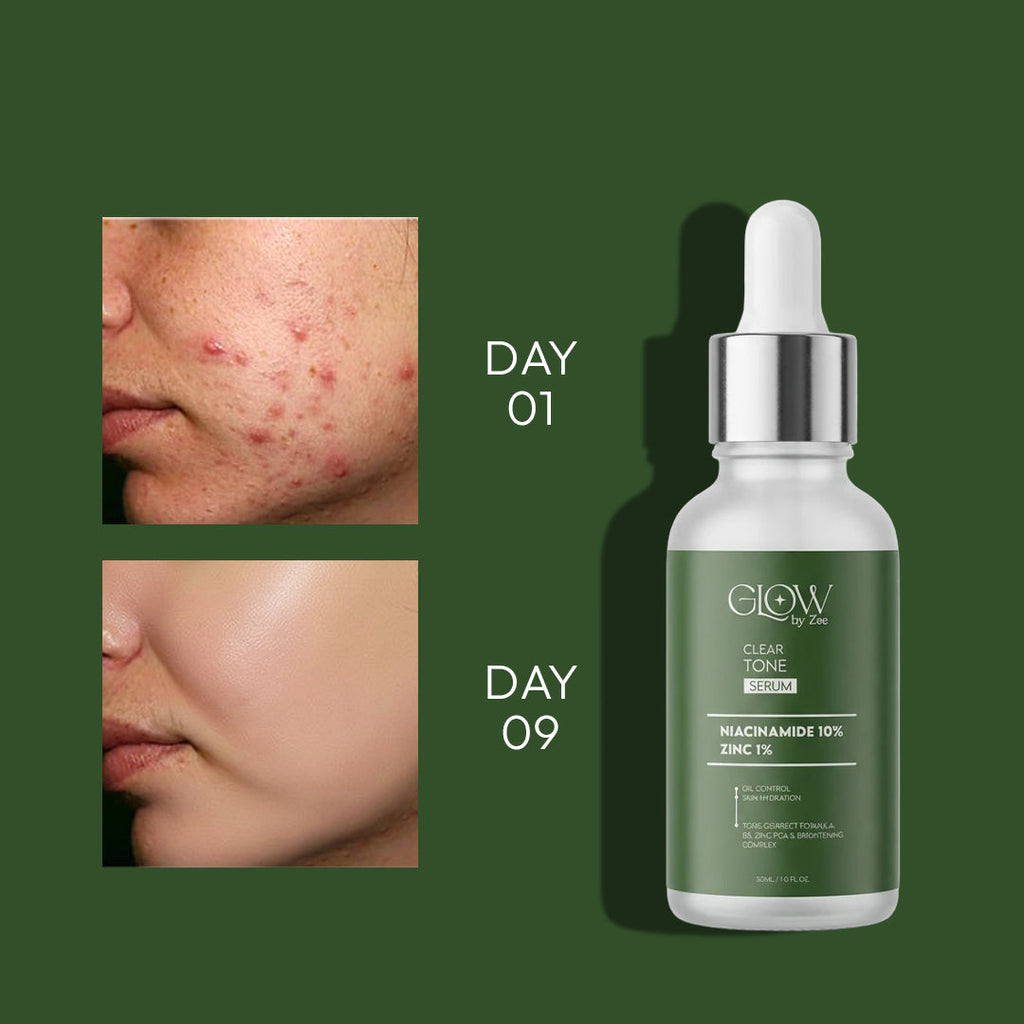 Niacinamide Skin Repairing Serum